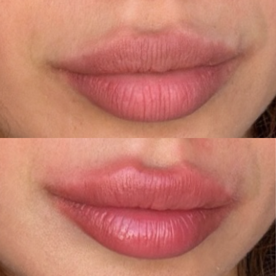 Extreme Lip Plumper